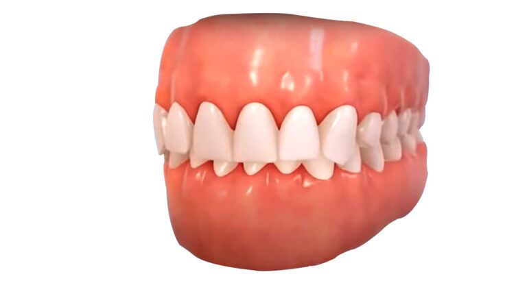 Deep Bite